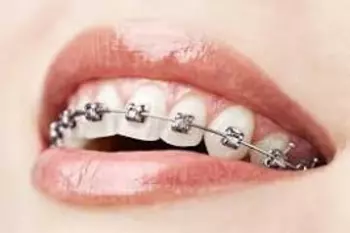 orthodontie